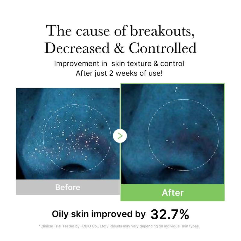 [Official Shop] Exosome Cica Toner | Daily Soothing Toner with Exosome Cica, Heartleaf, Tea Tree | Korean Skin Care for Stressed Skin